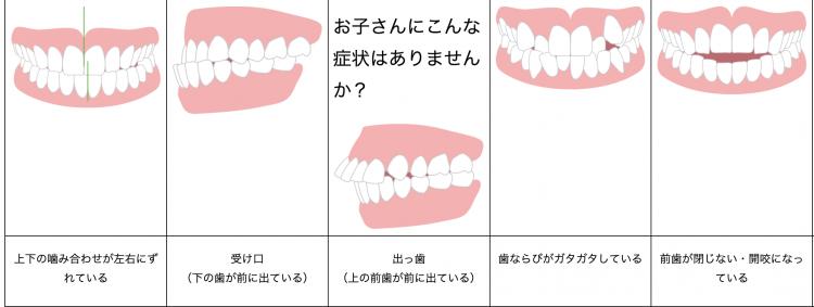 幼児矯正の考え方
