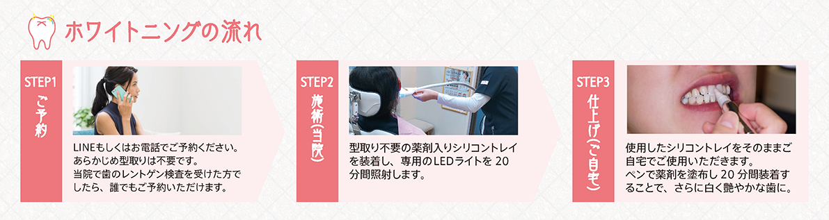 「準備時間1分」「施術時間20分」