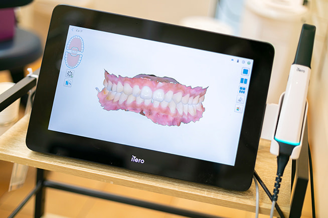 矯正用スキャナー（iTero）