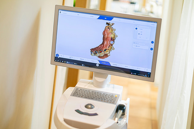 インプラント・補綴用スキャナー（プライムスキャン２）