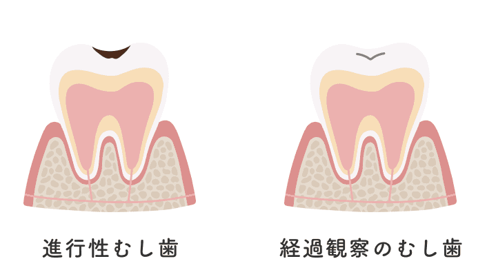 食育・口腔機能サポート