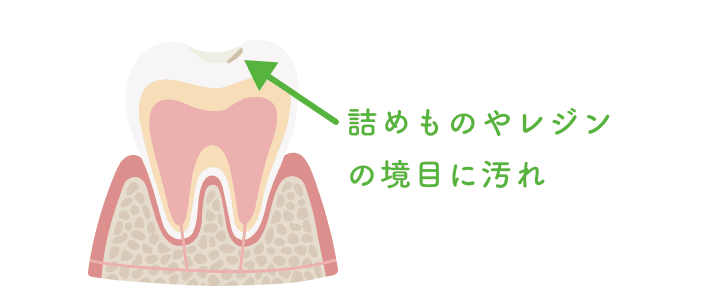食育・口腔機能サポート